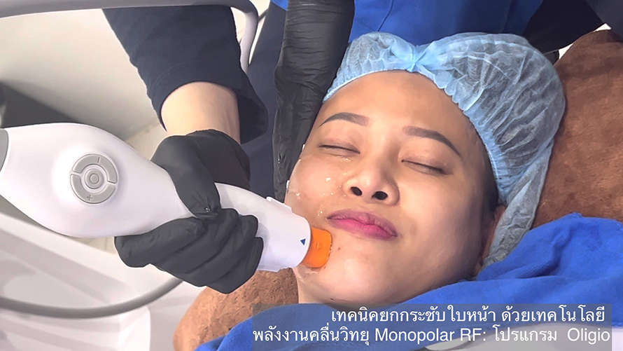 โปรแกรม Oligio การประเมินและการรักษา โปรแกรม Oligio การประเมินและการรักษา