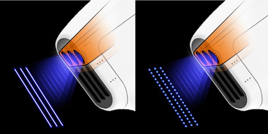 เทคนิค ยกกระชับใบหน้าและคิ้วด้วย เทคนิค Triple-Lined Multifocused Ultrasound เทคนิค ยกกระชับใบหน้าและคิ้วด้วย เทคนิค Triple-Lined Multifocused Ultrasound