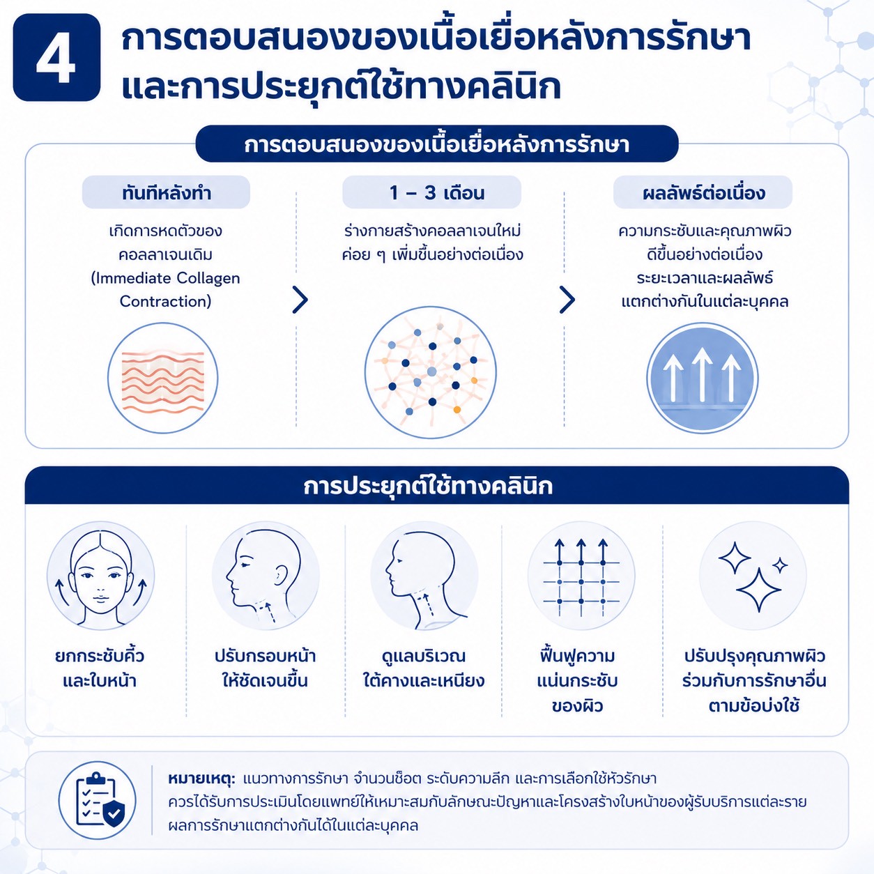 เทคนิคการยกกระชับใบหน้าและคิ้วด้วย Triple-Lined Multifocused Ultrasound: โปรแกรม X-Triple เทคนิคการยกกระชับใบหน้าและคิ้วด้วย Triple-Lined Multifocused Ultrasound: โปรแกรม X-Triple
