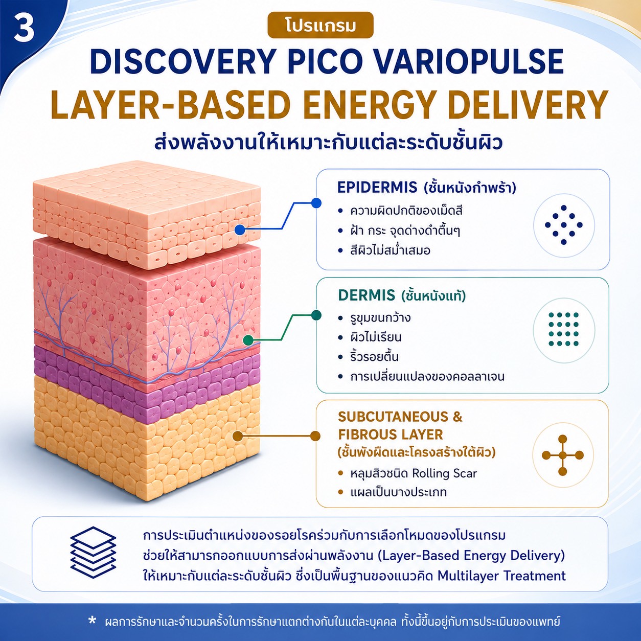 โปรแกรม Multimodality & Multilayer Discovery Pico VarioPulse Treatment โปรแกรม Multimodality & Multilayer Discovery Pico VarioPulse Treatment