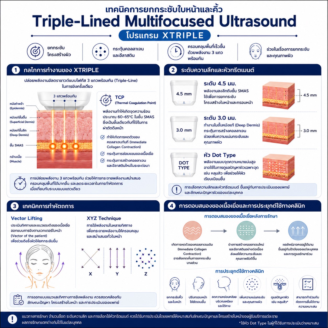 เทคนิคการยกกระชับใบหน้าและคิ้วด้วย Triple-Lined Multifocused Ultrasound: โปรแกรม X-Triple
