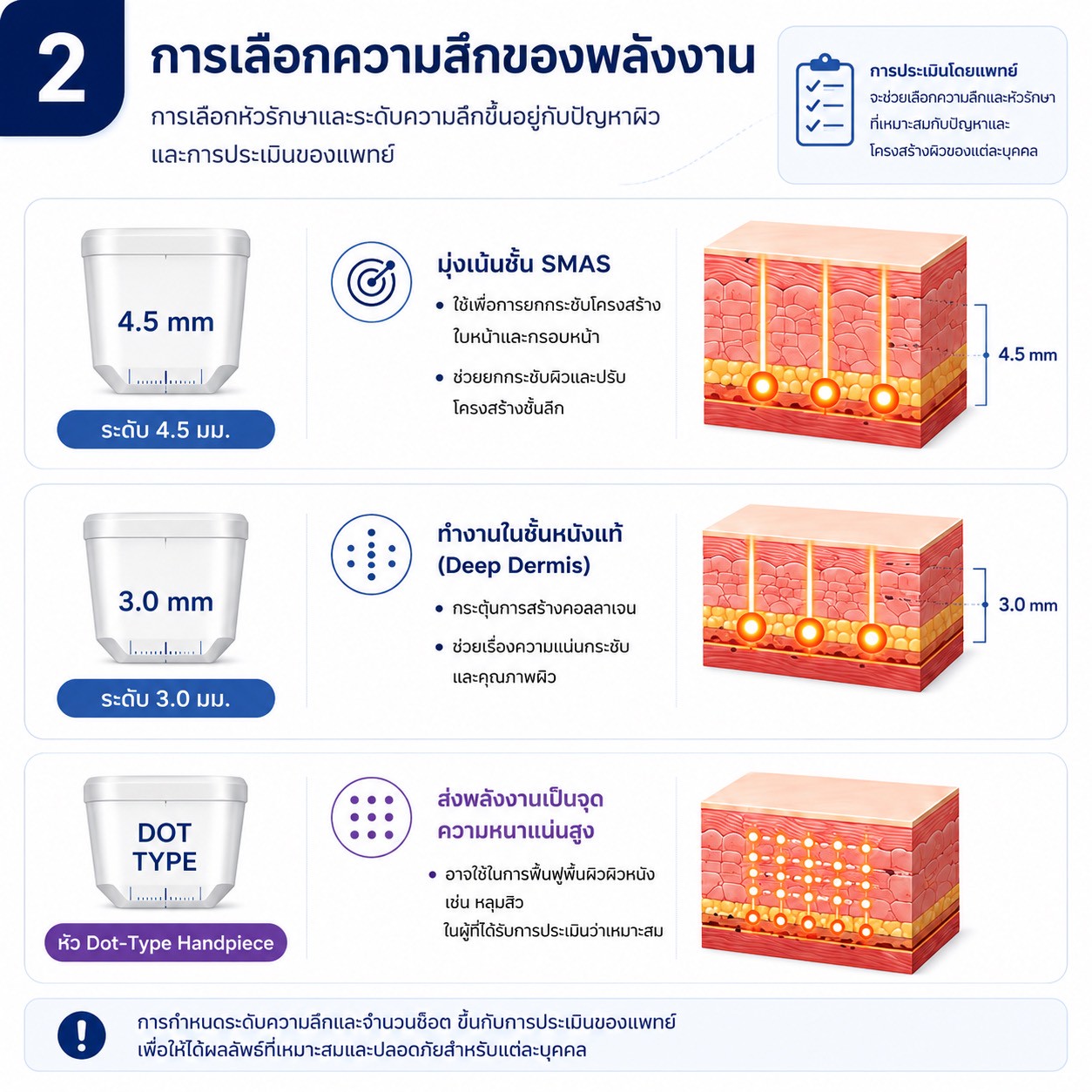 เทคนิคการยกกระชับใบหน้าและคิ้วด้วย Triple-Lined Multifocused Ultrasound: โปรแกรม X-Triple