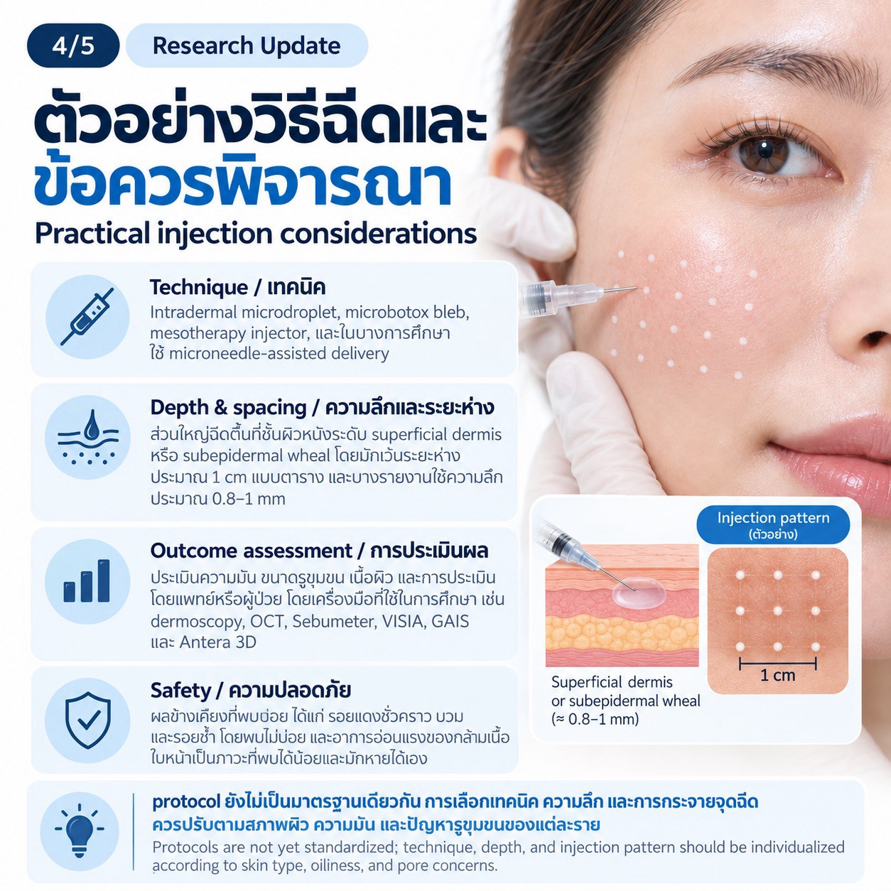 งานวิจัยทบทวน: การฉีด Botulinum Toxin Type A ในชั้นผิวเพื่อช่วยลดความมันและรูขุมขนกว้าง งานวิจัยทบทวน: การฉีด Botulinum Toxin Type A ในชั้นผิวเพื่อช่วยลดความมันและรูขุมขนกว้าง