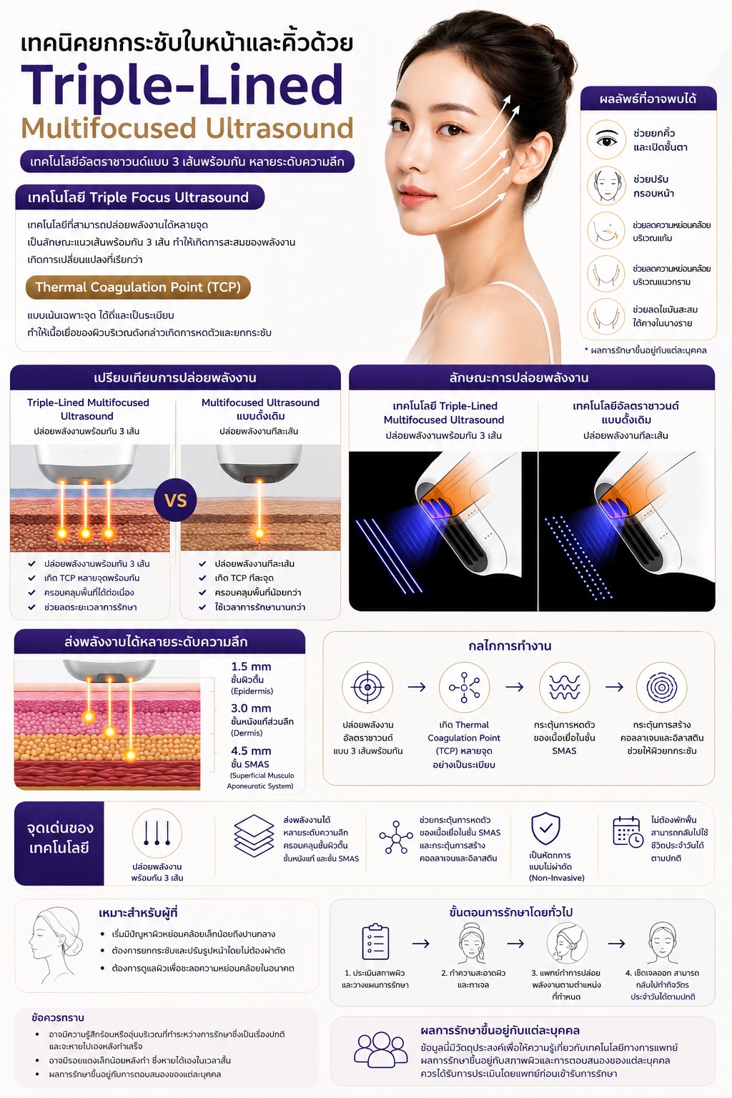 เทคนิค ยกกระชับใบหน้าและคิ้วด้วย เทคนิค Triple-Lined Multifocused Ultrasound เทคนิค ยกกระชับใบหน้าและคิ้วด้วย เทคนิค Triple-Lined Multifocused Ultrasound