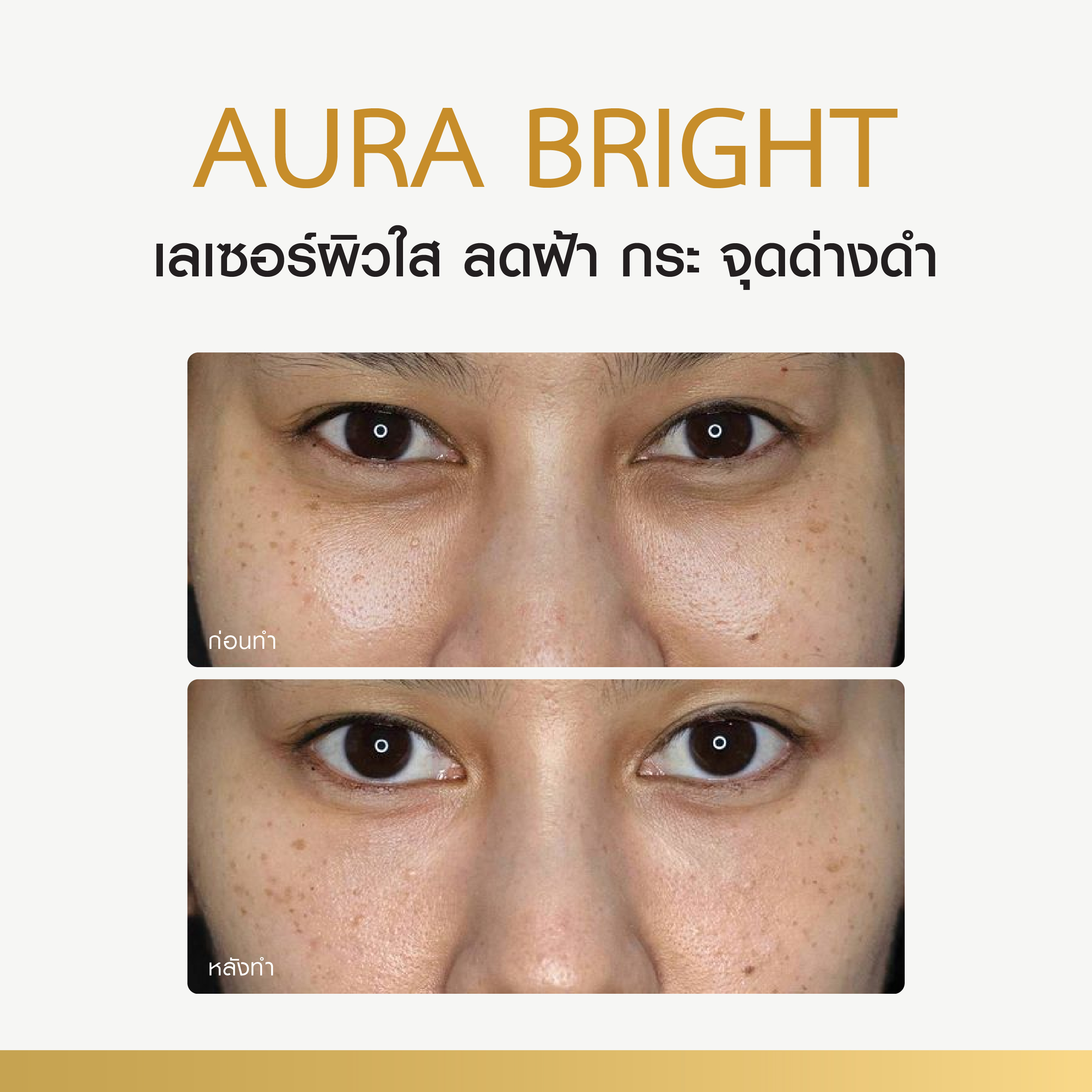 Review Aura Bright - thescarlettclinic