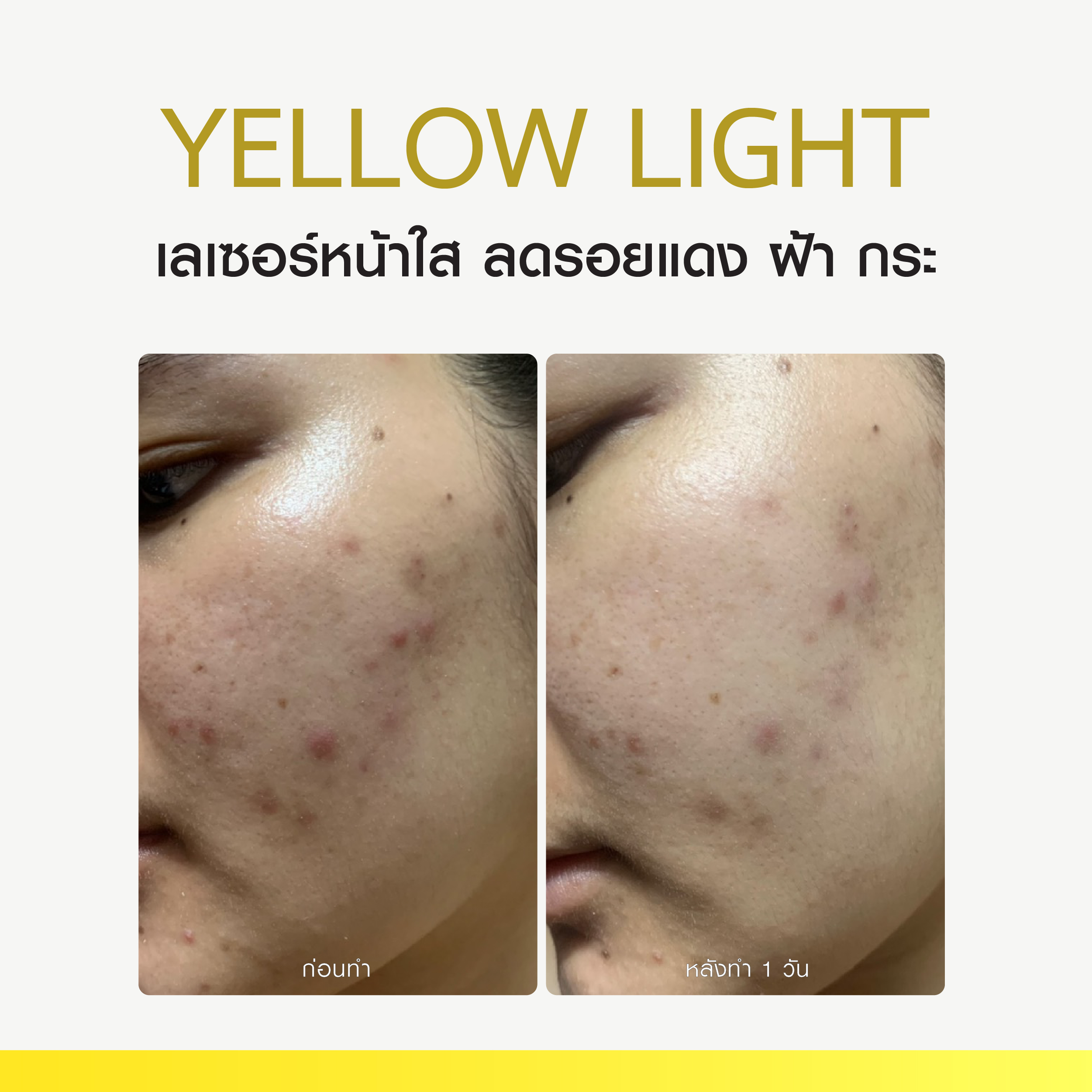 Review Yellow Light