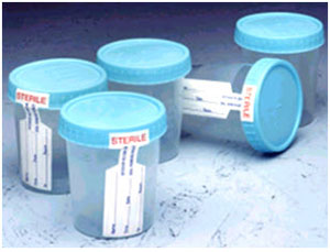 Specimen Container 120 ml.(Sterile)