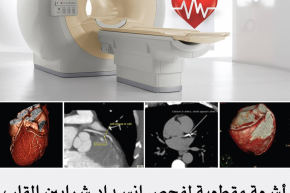 جهاز الأشعة المقطعية المتطور ذو الـ64 لاقط يغني عن القسطرة التشخيصية ويقوم بتصوير شرايين القلب دون ألم أو تخدير !!