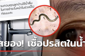 Parasites found in water at a condominium in Bangkok, more than 200 residents suffer from red eye