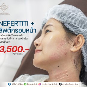 ฉีดโบลิฟต์กรอบหน้า คืออะไร? NEFERTITI LIFT คืออะไร?