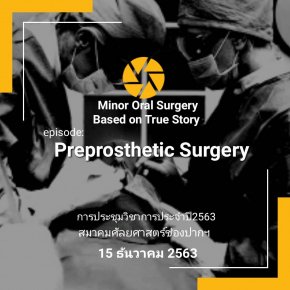 Proprosthetic Surgery by Asso Maxillofacial