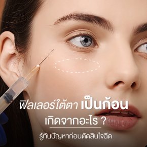 ฟิลเลอร์ใต้ตาเป็นก้อน เกิดจากอะไร? รู้ทันปัญหาก่อนตัดสินใจฉีด