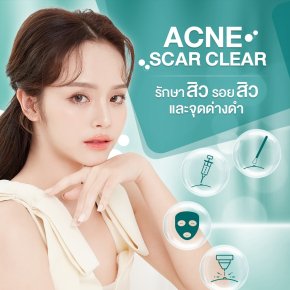 รักษาสิว และรอยสิว ครบจบไม่ต้องจ่ายเพิ่ม ACNE SCAR CLEAR