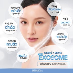 ผลลัพธ์ Exosome