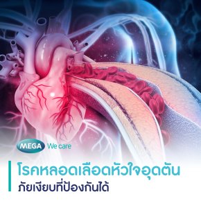 ‘โรคหลอดเลือดหัวใจอุดตัน’ ภัยเงียบที่ป้องกันได้