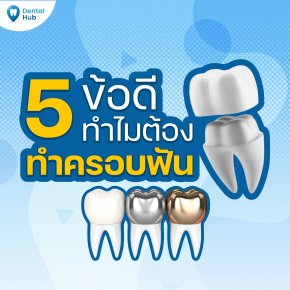5ข้อดีทำไมต้องทำครอบฟัน