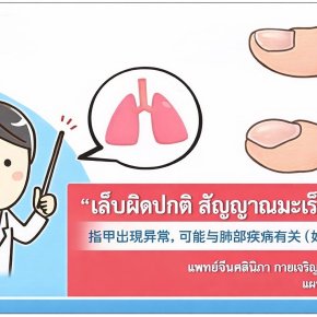 冯解语中医师讲解指甲异常，可能是肺癌信号!