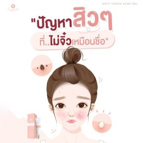ปัญหา สิวๆ ที่...ไม่จิ๋วเหมือนชื่อ