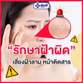 รักษาฝ้าผิด เสี่ยงฝ้าลาม หน้าติดสาร