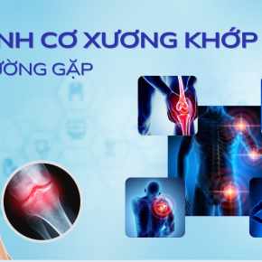 Các Dấu Hiệu Nhận Biết Sớm Bệnh Xương Khớp  