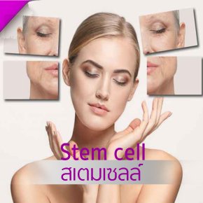 Stem cell