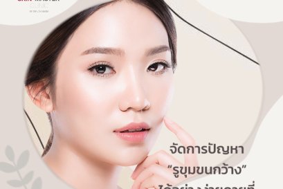 จัดการปัญหา “รูขุมขนกว้าง” ได้อย่างง่ายดาย ที่ Skin Master Clinic