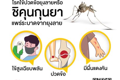 ชิกุนคุนยา เป็นแล้วอาจจะเป็นเรื้อรัง