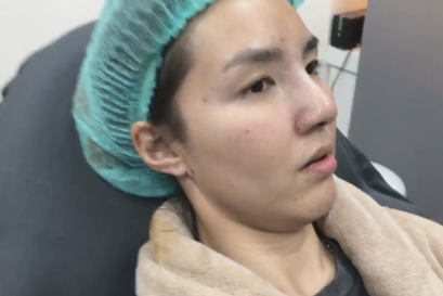 FACEBOOK LIVE :  งานแก้จมูกคุณ พิม-ชญานิสา BY พี่หมอดรีม