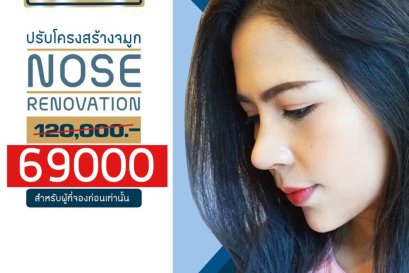 โปรโมชั่นปรับโครงสร้างจมูกท็อปออพชั่น 