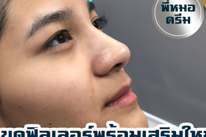 รวมวีดีโอ LIVE FACEBOOK 