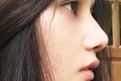 รีวิว: วันนี้จะมารีวิวการศัลยกรรมครั้งแรกเลยคือทำการเสริมจมูก ตะไบฮัมพ์ที่ Narinthra