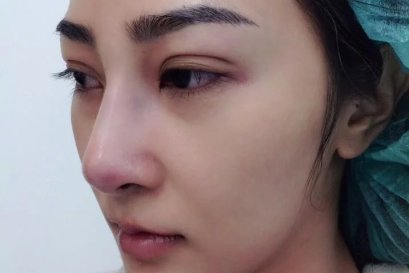 บทความ: รองปลายด้วยกระดูกอ่อนหลังหูจำเป็นขนาดไหน ? 