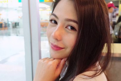 รีวิวงานแก้จมูกที่ Narinthra clinic  ด้วยเทคนิคการปรับโครงสร้าง Nose Ranovation 