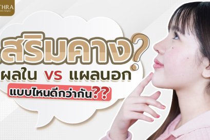 เสริมคางแผลในvsแผลนอก