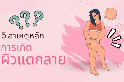 5 สาเหตุหลักที่ทำให้เกิดผิวแตกลาย พร้อมเคล็ดลับดูแลผิวให้กลับมาเรียบเนียน