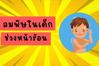 ลมพิษในเด็ก ช่วงหน้าร้อน