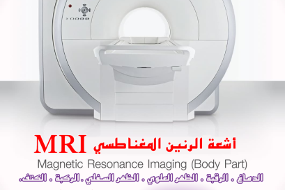 عرض الأشعة الرنين المغناطسي
