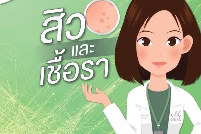 สิว การรักษา เชื้อสิว