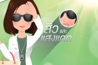 สิวและแดด