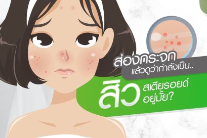 ส่องกระจกแล้วดูว่ากำลังเป็นสิวสเตียรอยด์อยู่ไหม