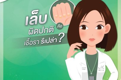 เล็บไม่สวย..เชื้อราไหมนะ