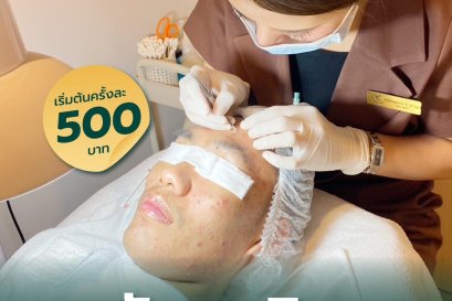 รักษาสิว 