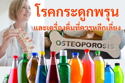 โรคกระดูกพรุน: การป้องกันและบทบาทของแคลเซียม ควรหลีกเลี่ยงเครื่องดื่ม และอาหารแบบใด
