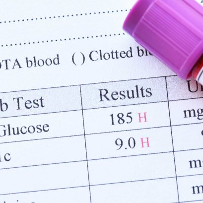 HbA1C Analyzer