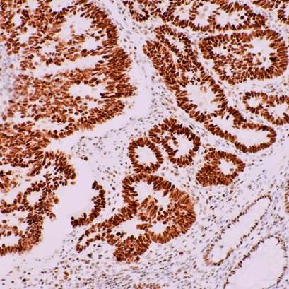 Immunohistochemistry Analyzer