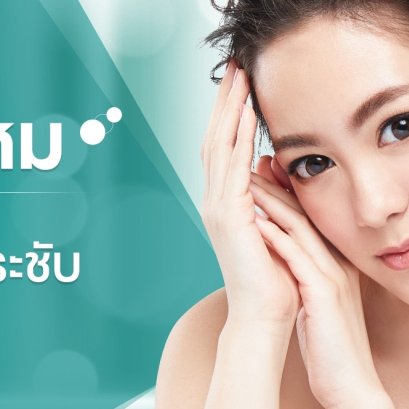 ร้อยไหม Thread Lifting