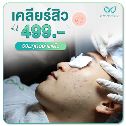 รักษาสิว อะตอมคลินิก
