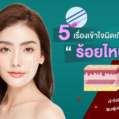 5 เรื่องเข้าใจผิด เกี่ยวกับ การร้อยไหม