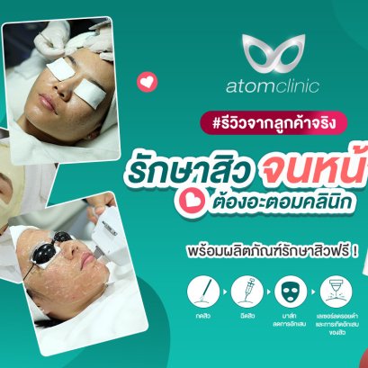 รีวิวจากลูกค้าจริง รักษาสิว กับอะตอมคลินิก หน้าใส สิวหายเกลี้ยง ด้วยโปรแกรม Acne Scar Clear