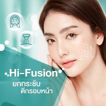 Hi-Fusion